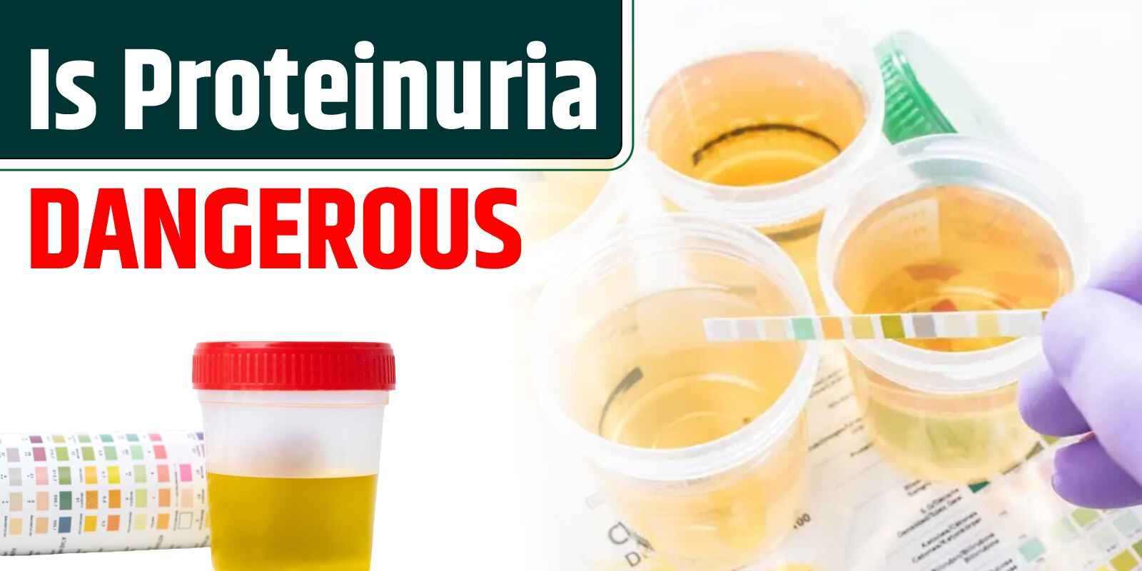 Is Proteinuria Dangerous